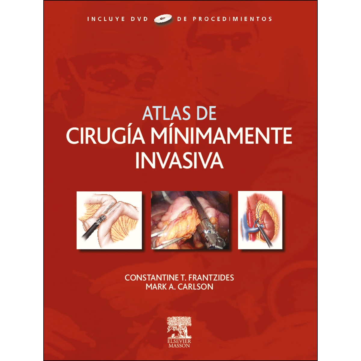 FRANTZIDES - ATLAS DE CIRUGIA MINIMAMENTE INVASIVA - ELSEVIER -2009 1RA