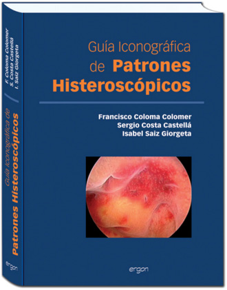 COLOMA - GUIA ICONOGRAFICADE PATRONES HISTEROSCOPICOS - ERGON 2013